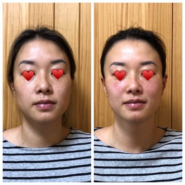 沖田式 顔の整体法 手技DVD 割引