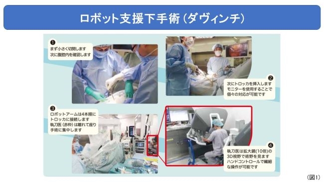 泌尿器科 | 診療科・部門 | 名古屋市立大学医学部附属東部医療センター