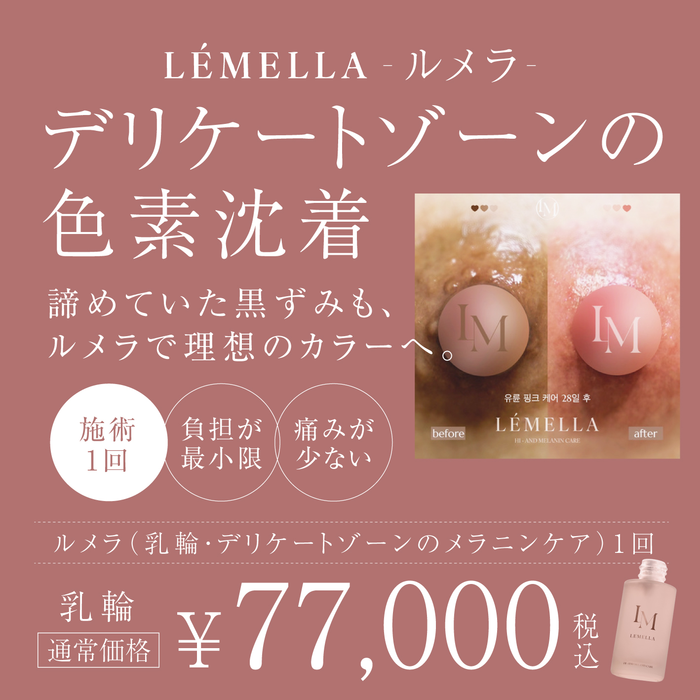 LÉMELLA WHITENING CREAM ルメラ ボディ ルメラ ホワイトニング