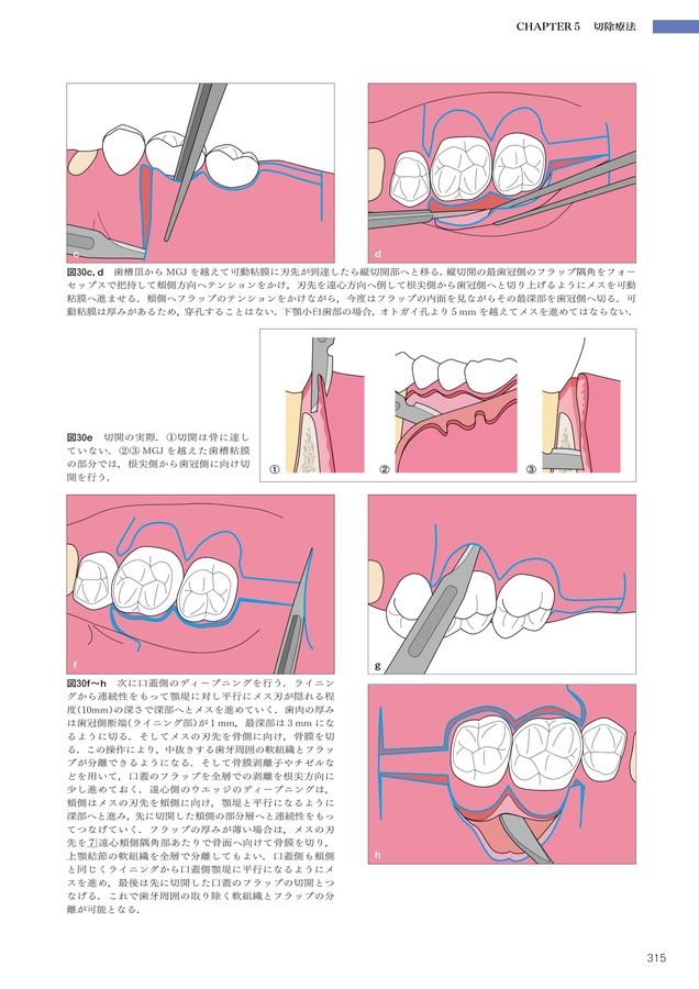 5-Dコンセンサス 歯の保存にこだわる