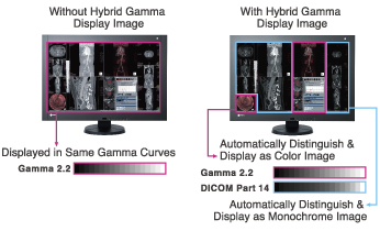 RadiForce RX440 | EIZO