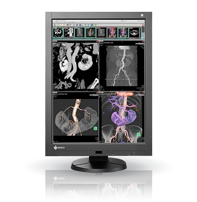 RadiForce RX340 | EIZO