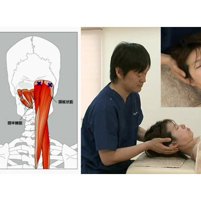 ストレイン&カウンターストレイン | 日本スリービー・サイエンティフィック