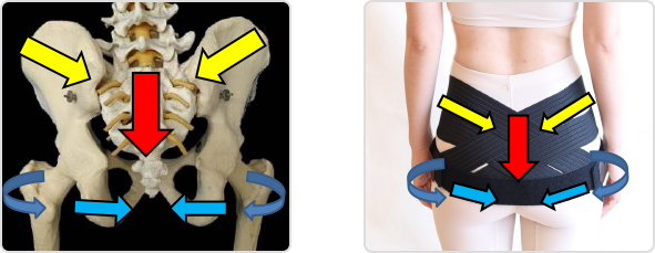 反り腰を矯正できる唯一の骨盤ベルト 【ペルビス】 | 三徳接骨院三徳接骨院