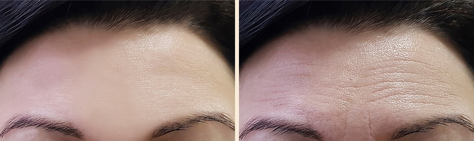 リンクル リフト クリーム｜クラブコスメチックス