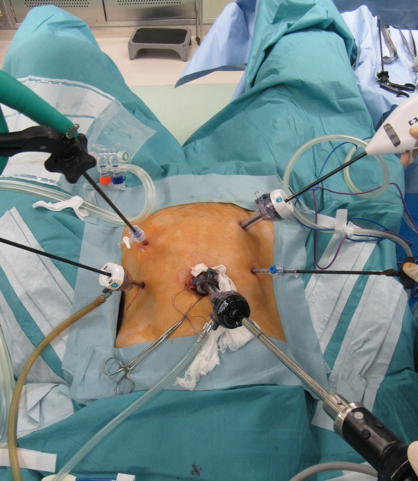 下部消化管(小腸・大腸) ｜消化器・一般外科｜診療科・部門紹介｜香川