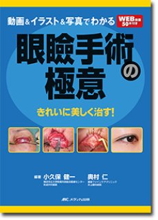 動画＆イラスト＆写真でわかる 眼瞼手術の極意 advance - 眼科専門書店