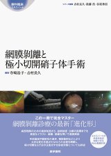 網膜疾患・硝子体手術 - 眼科専門書店 オー・ビー・エス online shop