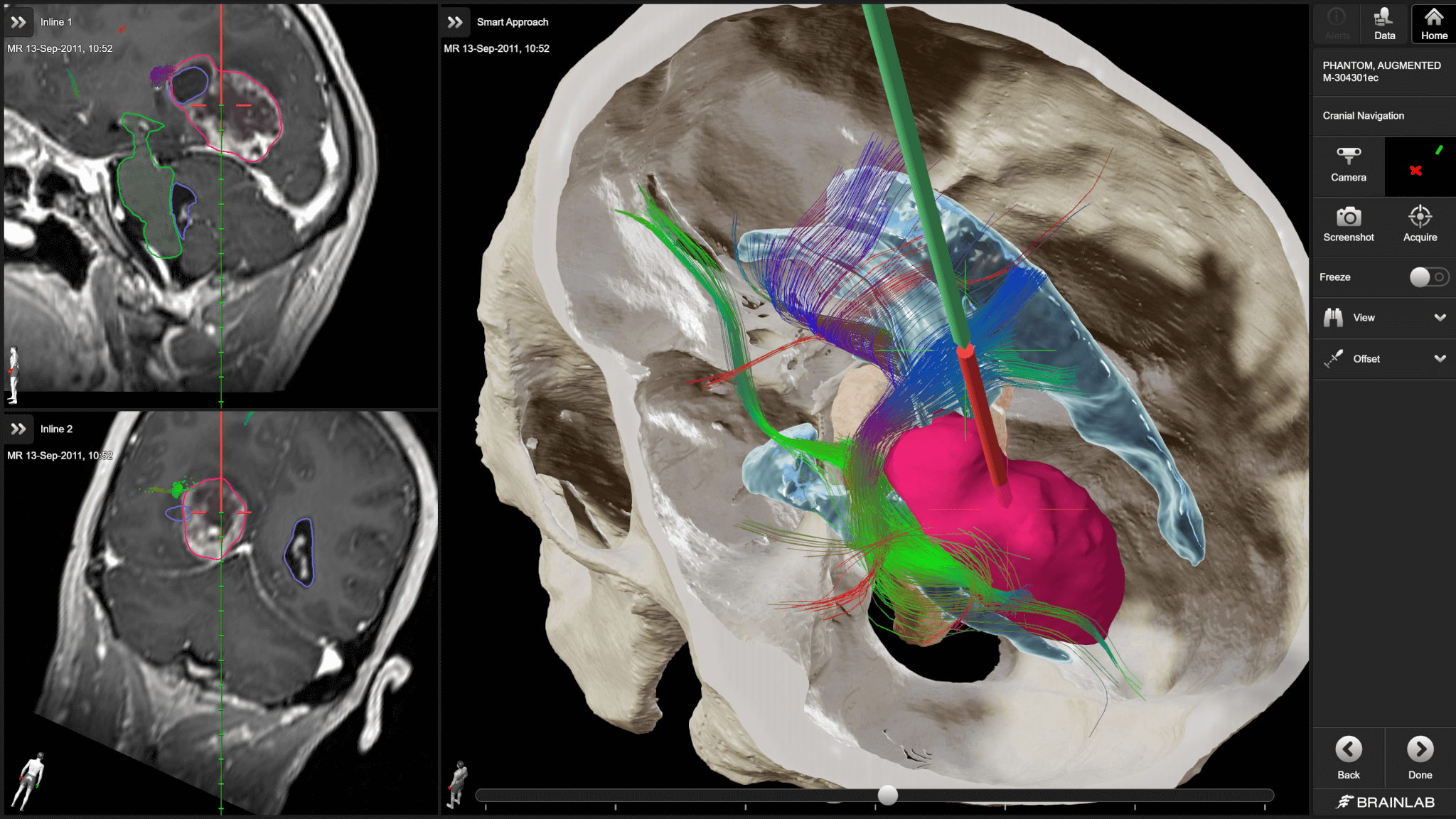 BRAIN NAVIGATION ブレインナビゲーション DVD 特典 テキスト BRAIN