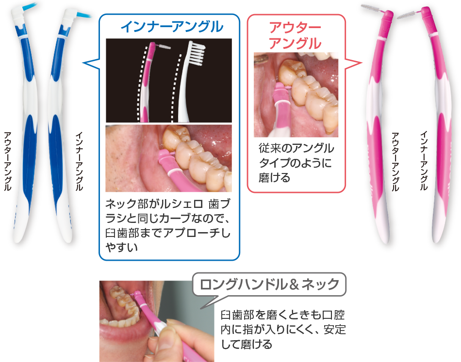 歯間清掃用具のひみつ | ルシェロ（ruscello®） | 株式会社ジーシー