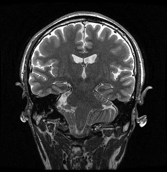 GEヘルスケア・ジャパン、新プラットホーム「AIR™ IQ Edition」を全MRI