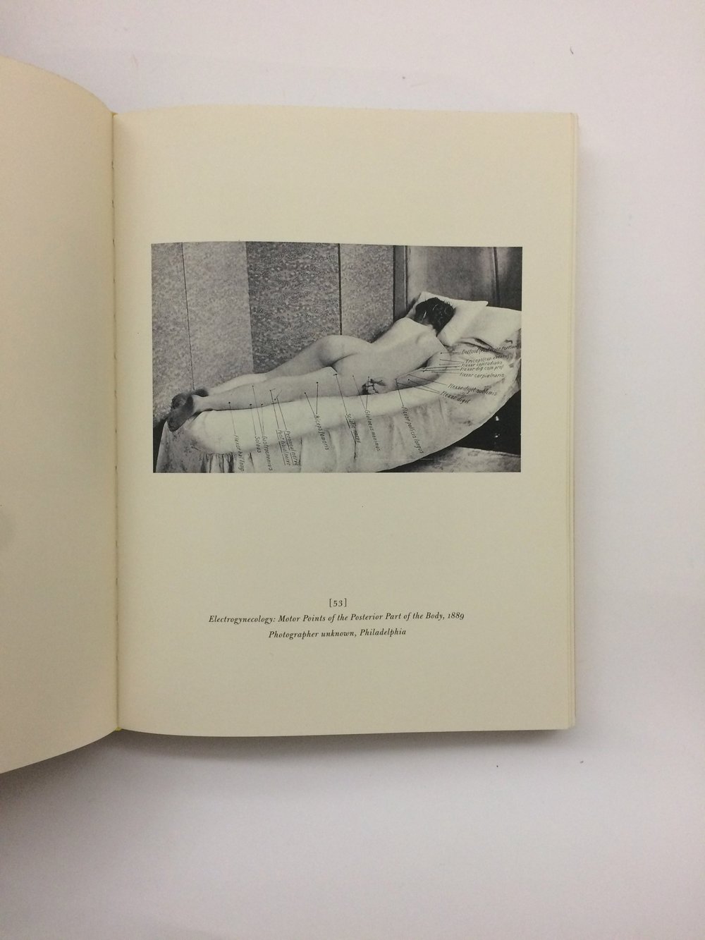 A Morning's Work: Medical Photographs from The Burns Archive