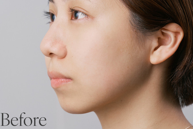 Face Powder – Domohorn Wrinkle Global