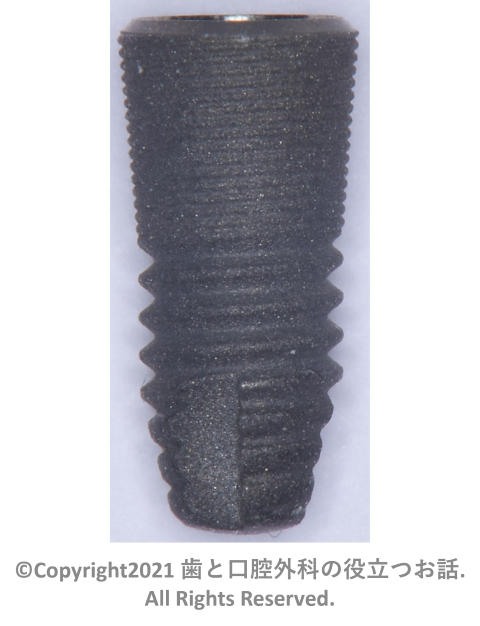 Astra Tech Implant OsseoSpeed EV Conicalについて | 歯と口腔外科の