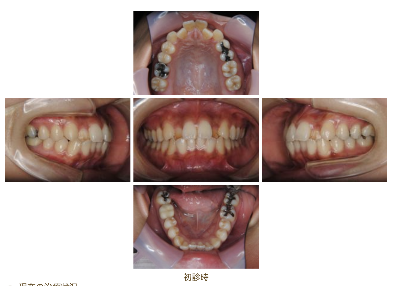 精度の高い見えない矯正治療は熊本DAN矯正歯科クリニック｜お知らせ