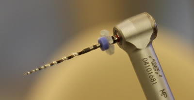 ニッケルチタンファイル