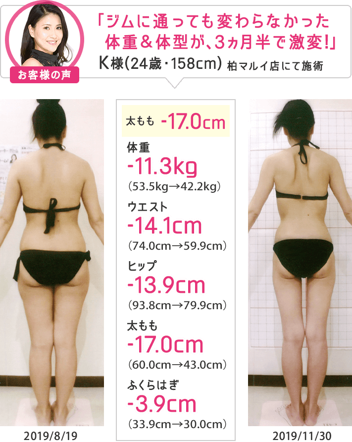 痩身エステなら目指せ！合計-8cmやせる体験｜エステのエルセーヌ