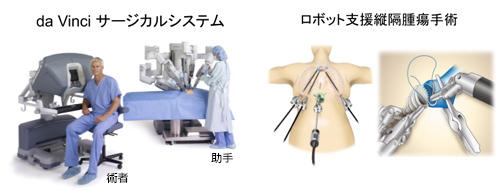 藤田医科大学岡崎医療センター 呼吸器外科