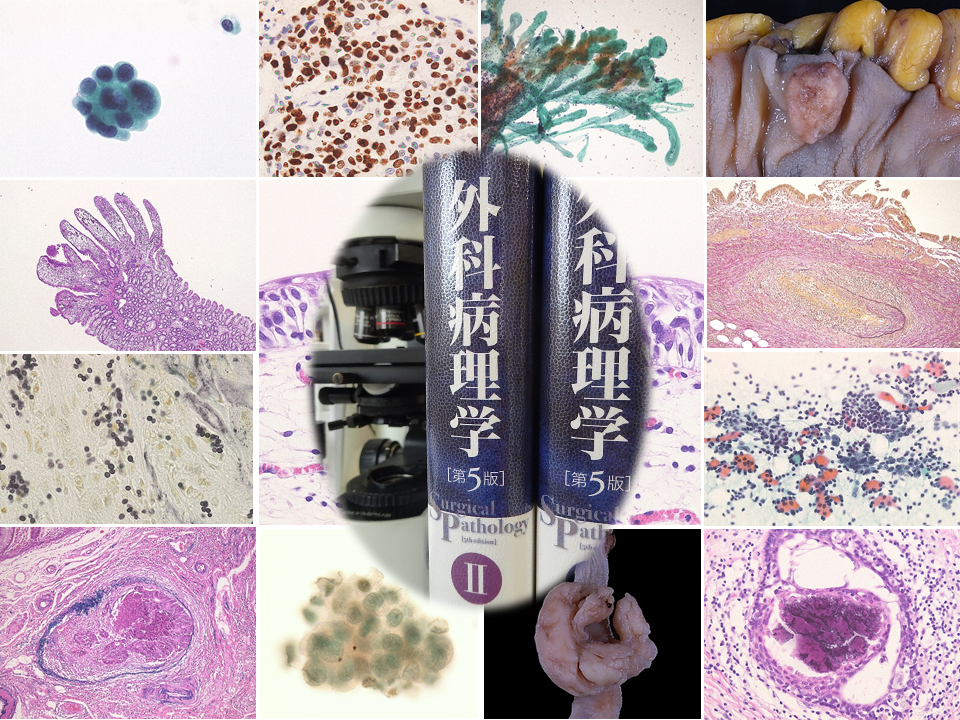 皮膚病理組織診断学入門 裁断済みです 楽天市場】皮膚病理組織診断学