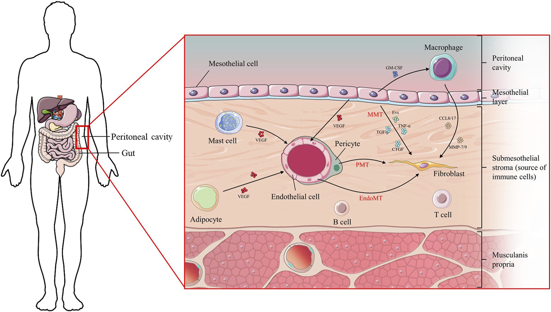 Frontiers | Intercellular communication in peritoneal dialysis