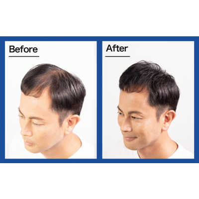 ルアン スーパーミリオンヘアー ミスト 165ml の通販 - カテゴリ