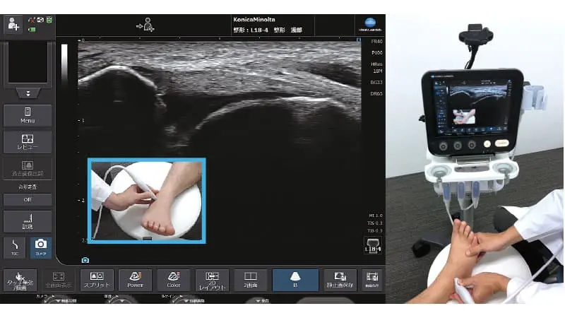 超音波診断装置 SNiBLE yb PREMIUM | コニカミノルタ