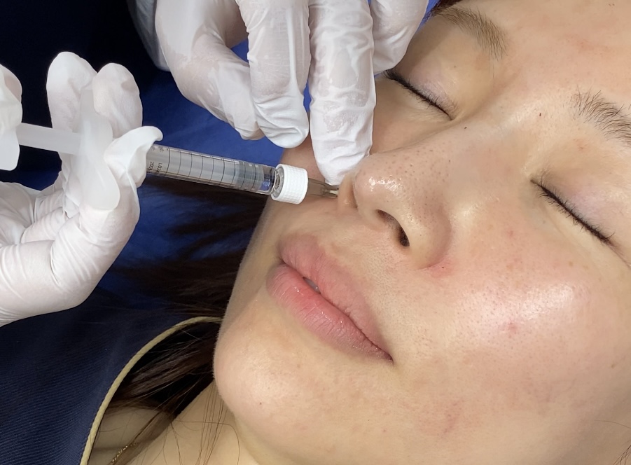 浜松でヒアルロン酸注射するならハートライフクリニック