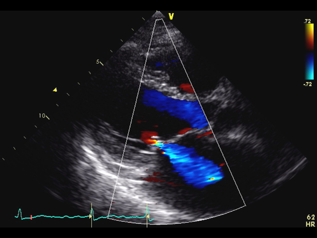 動画を見て学べる！心エコーレポート実例集50｜付録動画