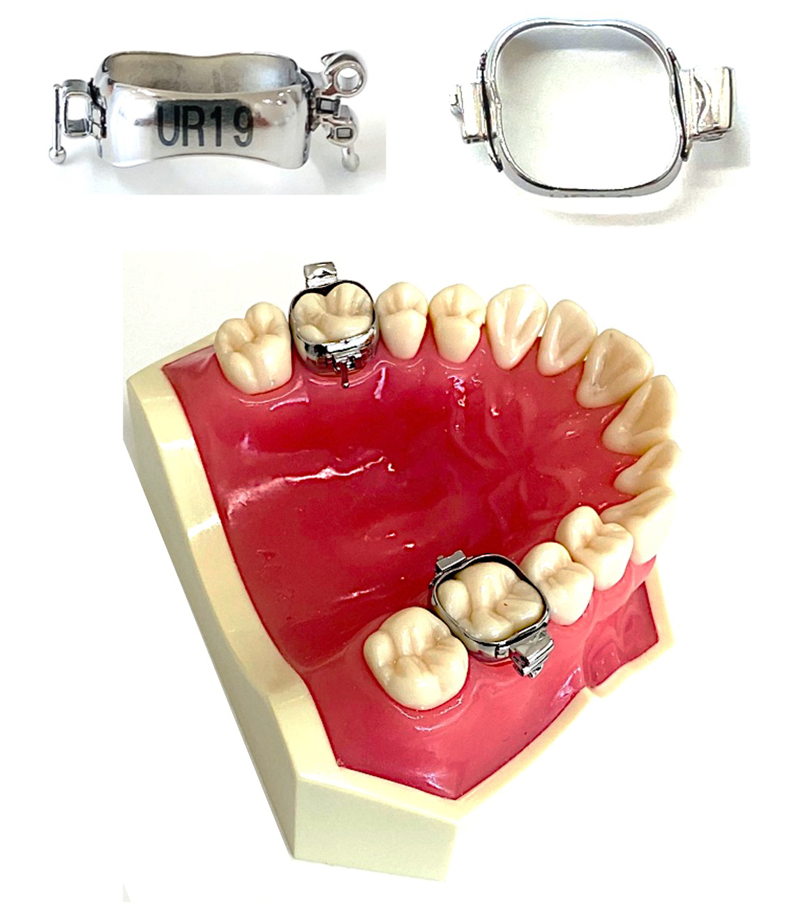 当院で使用している矯正装置について｜熊本東区の矯正歯科｜熊本東たけ