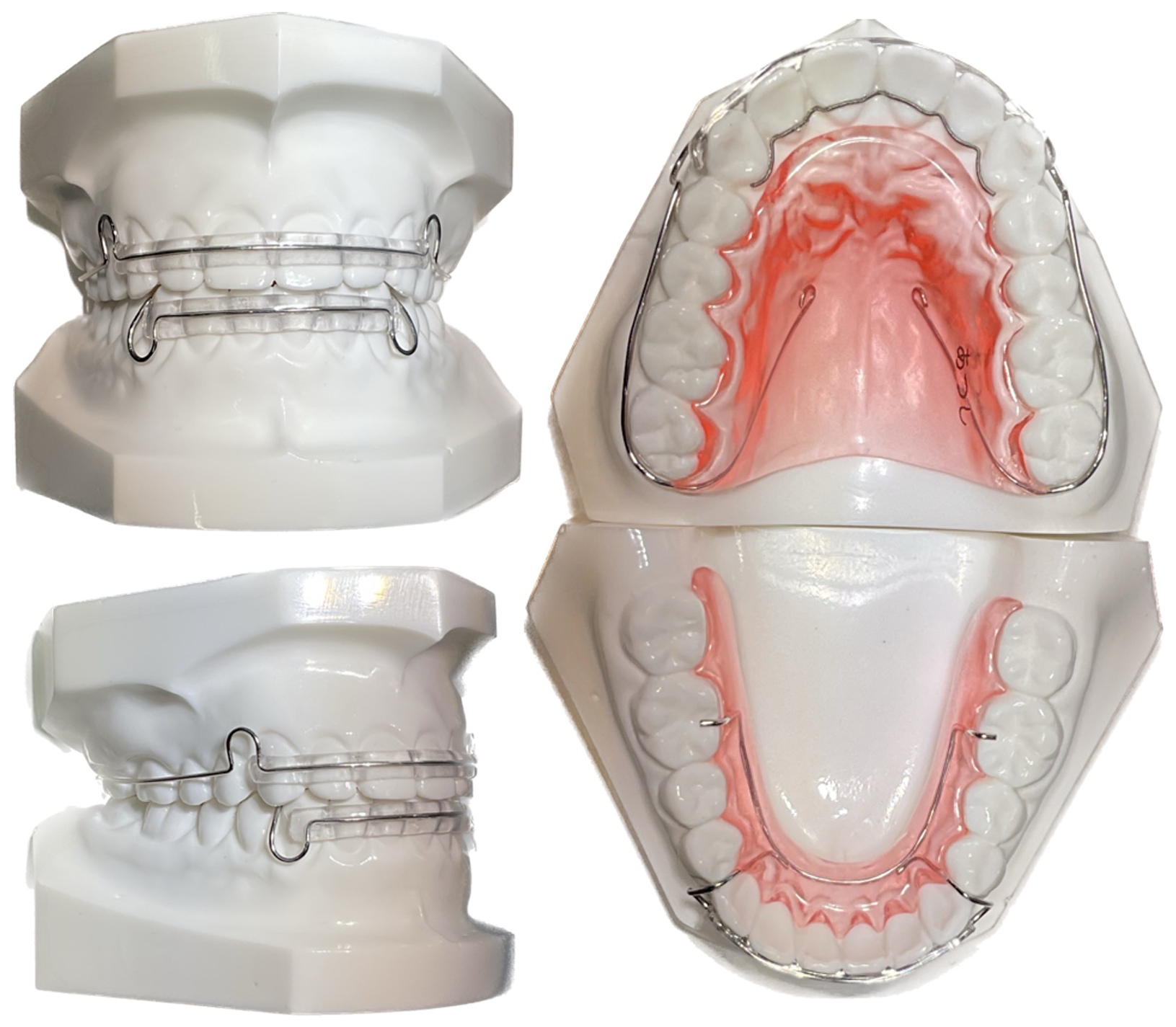 当院で使用している矯正装置について｜熊本東区の矯正歯科｜熊本東たけ