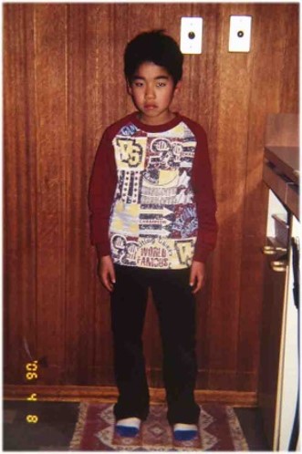 咬合育成の活用 MFT（顎顔面治療）のトレーニング方法を使用した小児