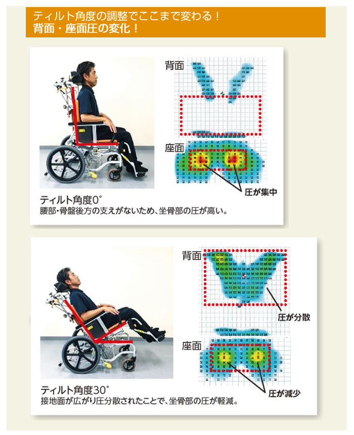 松永製作所】マイチルト-バリュー MH-VR-SE ティルリク ｜車いすの格安