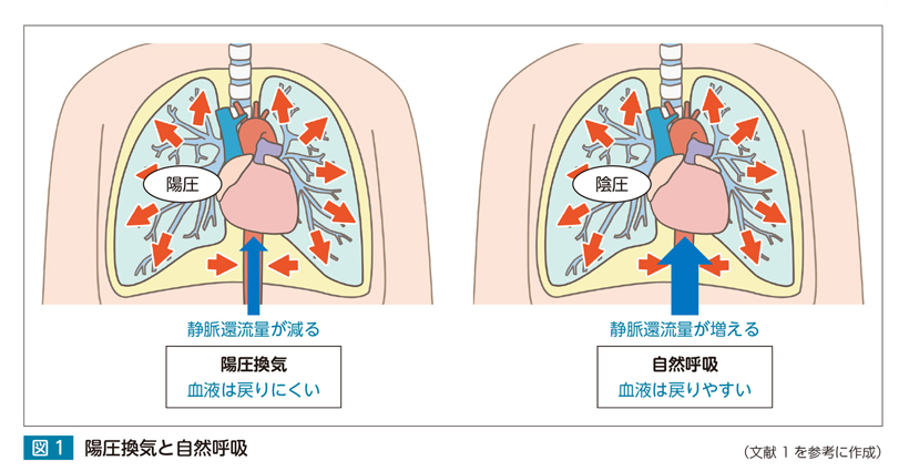 術後】特集：呼吸管理 | アイ・エム・アイ株式会社 IMI.Co.,Ltd