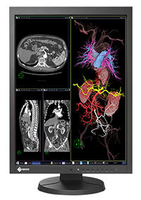 ナナオ，キャリブレーションセンサーを内蔵した2メガピクセル対応の