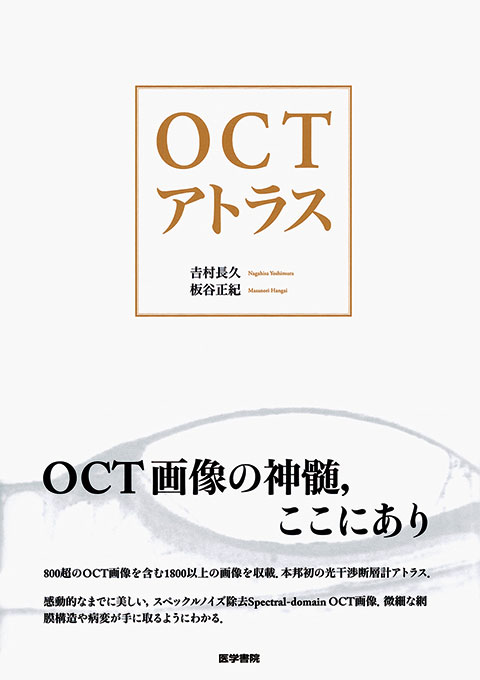 OCTアンギオグラフィコアアトラス | 書籍詳細 | 書籍 | 医学書院