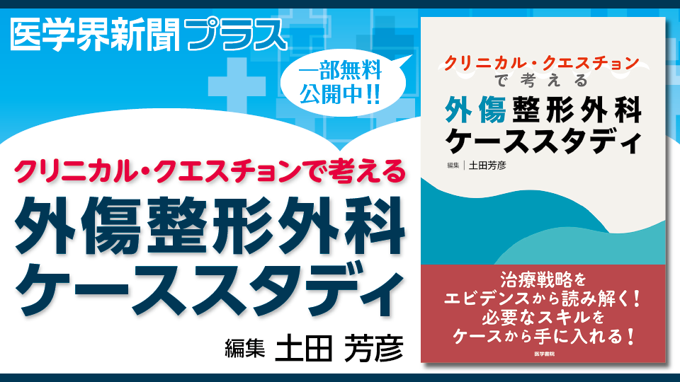 考える外傷整形外科！ 考える」外傷整形外科！ | 書籍詳細 | 書籍