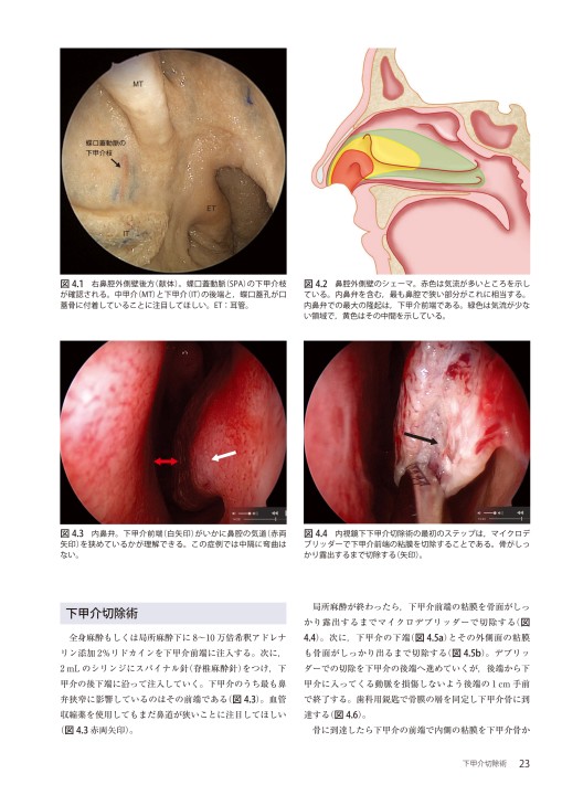 ウォーモルド内視鏡下鼻副鼻腔・頭蓋底手術 第1版』 立ち読み