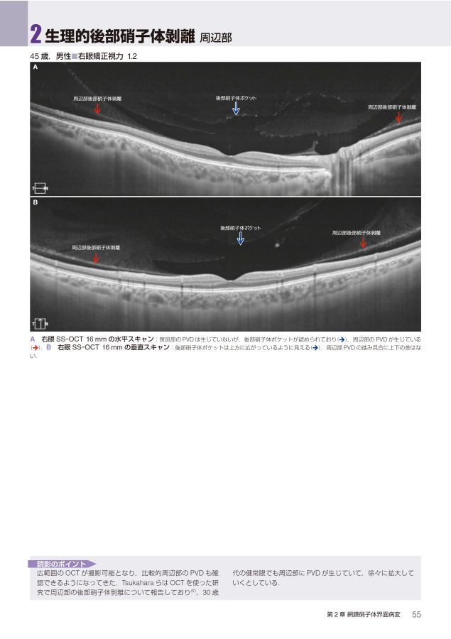 OCTアトラス_第2版_立読み