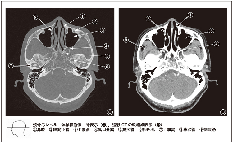 歯科臨床における画像診断アトラス 第2版 歯科臨床における画像診断