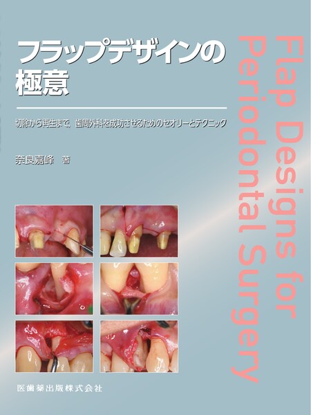 エンド・ペリオ病変の臨床 歯内－歯周複合病変 診断と治療の
