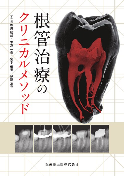 コンポジットレジン修復のManagement 審美修復を極めるための基本の