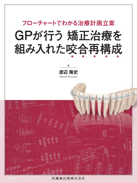 フローチャートでわかる治療計画立案 GPが行う矯正治療を組み入れた