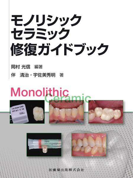 歯科臨床のエキスパートを目指してII ボンディッドレストレーション 6