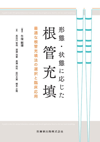 形態・状態に応じた根管充填 最適な根管充填法の選択と臨床応用／医歯