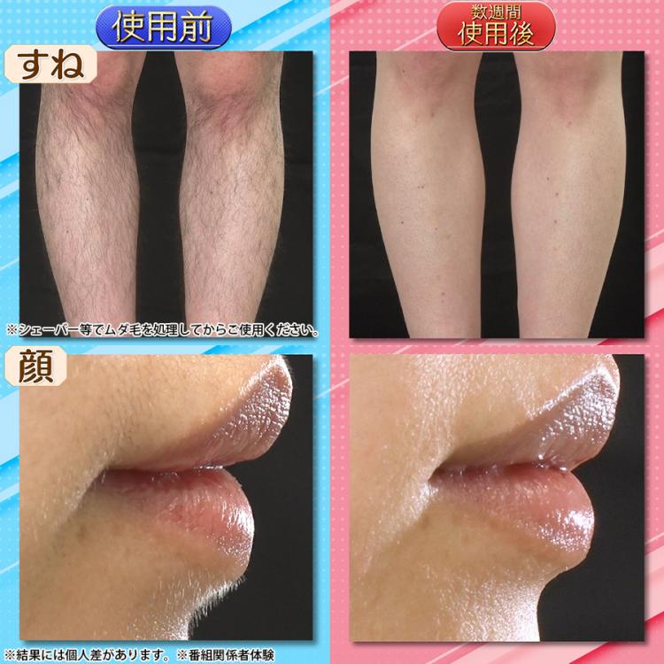 ReFa EPI GO(リファ エピ ゴー) | RKKショッピング