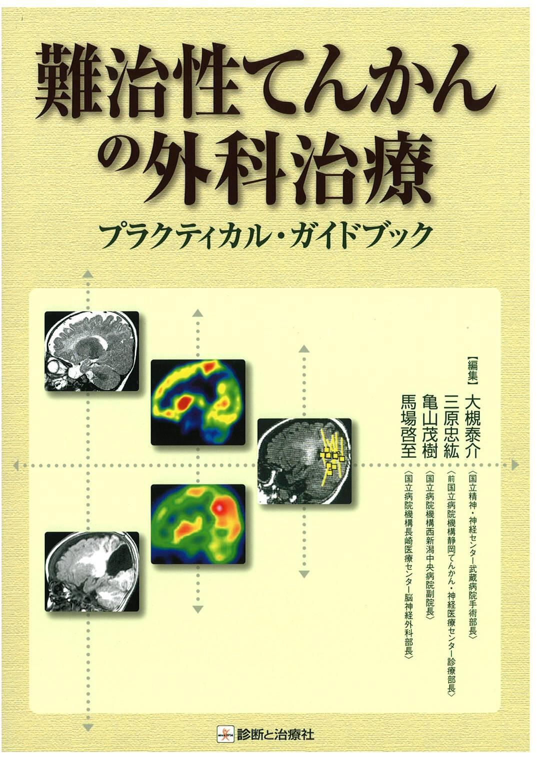 難治性てんかんの外科治療 | 公益社団法人 日本てんかん協会