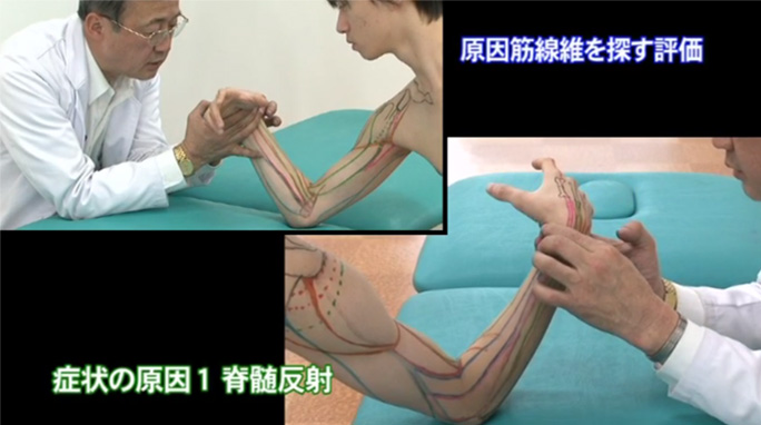 5】 部位別・症状別治療手技3 Myotuning Approach MTAマイオ