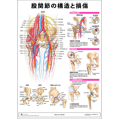 ミニポスター 股関節の構造と損傷