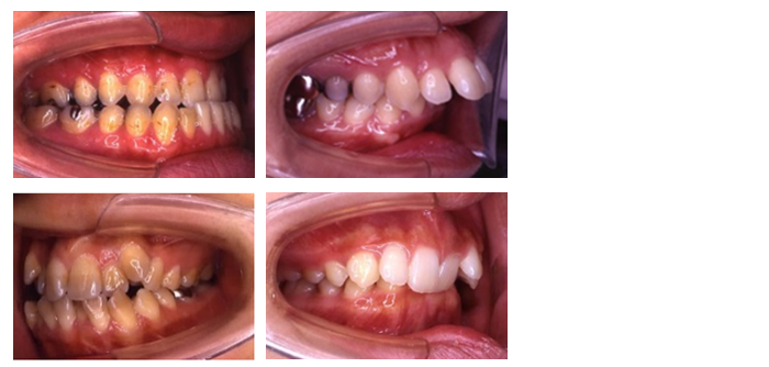 矯正歯科専門の開業医団体「日本臨床矯正歯科医会」