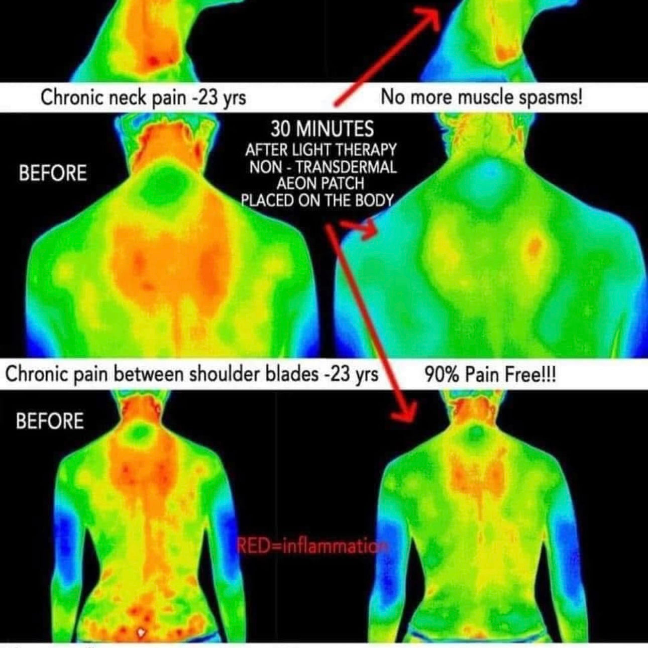 LifeWave Y-Age Aeon® Phototherapy Wellness Patches
